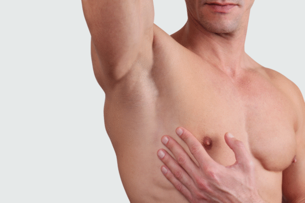 Botuliinisüstid liighigistamise vastu