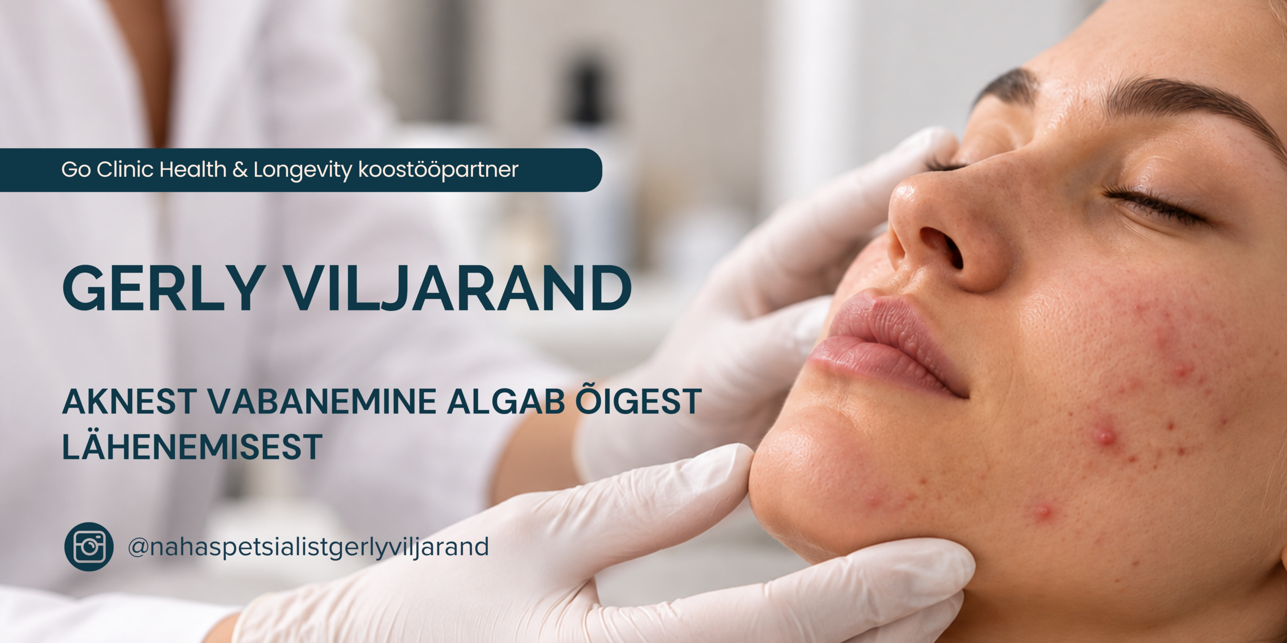 GERLY VILJARAND - AKNEST VABANEMINE ALGAB ÕIGEST LÄHENEMISEST